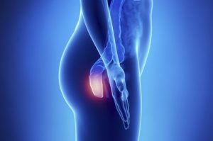 你應該知道的五種肛門癌症狀