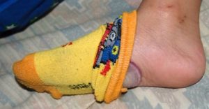 洋蔥塞腳底睡覺的好處