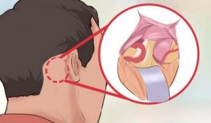 世上最痛-三叉神經痛的五件大小事