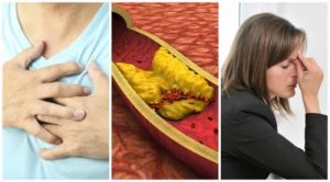 10 個高膽固醇不能忽視的徵狀