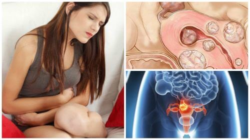 女性需知有關子宮肌瘤的五大事實