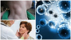 淋巴瘤:能即時發現即時治療的隱形癌症