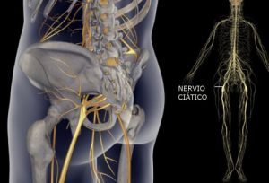 治療坐骨神經痛的簡單運動