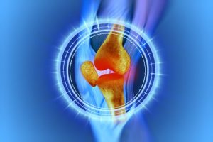 減輕膝蓋疼痛應該做的四件事