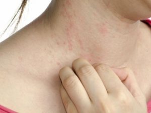 5種鮮為人知的糖尿病徵兆