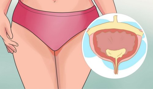膀胱過動症者該避免的食物