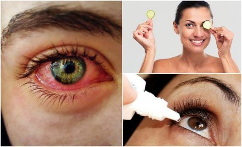 如何自然對抗乾眼症