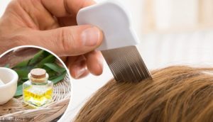 六種消除頭蝨的家用妙方