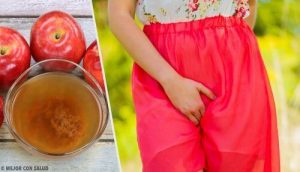 陰部瘙癢和灼燒感的治療方法