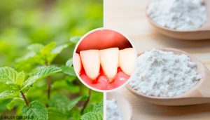 有效對付牙齦炎的五種居家療法