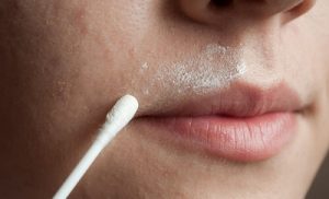 三招自製除毛術