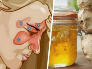 結合這兩種成份可舒緩鼻竇炎喔!