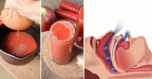 打鼾和睡眠呼吸中止症的自然療法