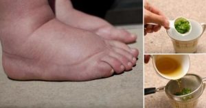 舒緩腳腫的最佳療法