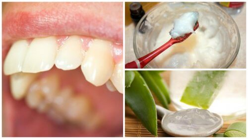 5個對付牙菌斑的天然療法