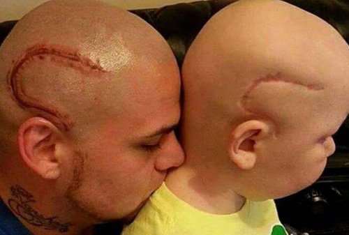 “現在我們一樣了”，刺了兒子癌症手術疤痕刺青的父親如是說