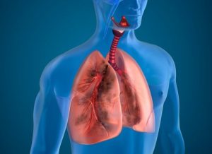 10種消炎潤肺的天然草本