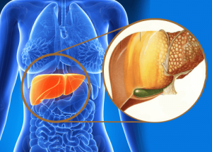 九大跡象顯示毒素正在你的肝臟裡聚積