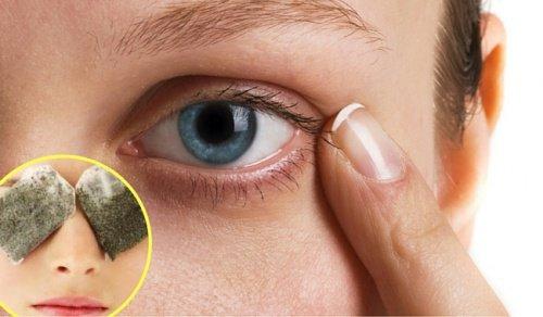 五個消除黑眼圈的自然療法