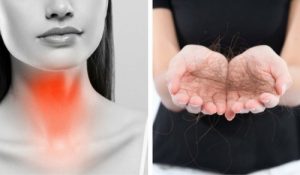 八招對抗甲狀腺引起的掉髮現象