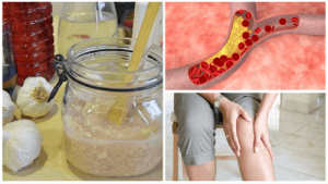 降低膽固醇及減少關節疼痛的天然糖漿