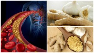 自製生薑蒜頭療方對抗高血壓和高膽固醇