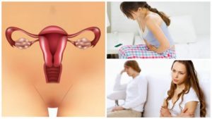 多囊性卵巢症候群你應該了解的七件事