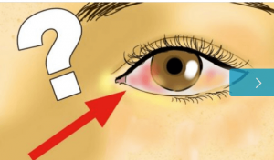 關於視網膜剝離你應了解的一切