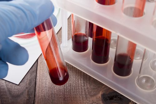 好消息：血液檢測能早期發現癌症！