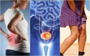 請注意這7種膀胱癌徵兆