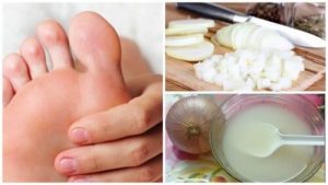 兩種天然成份讓你與腳底硬皮道別