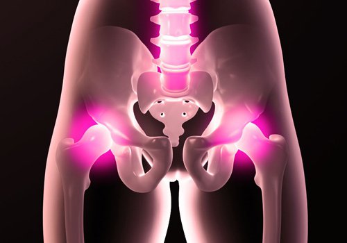 髖部疼痛