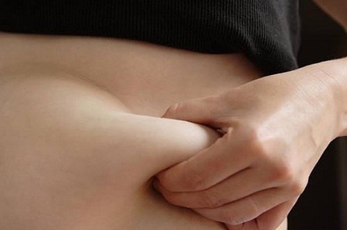 腹部脂肪