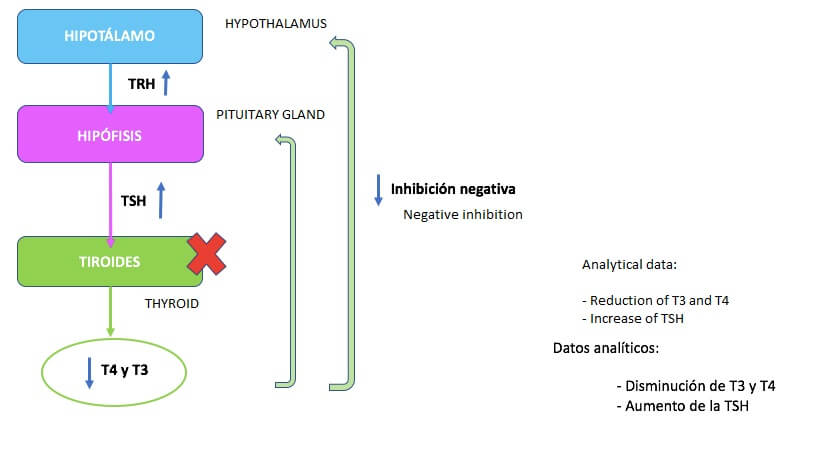 原發性甲狀腺機能低下症