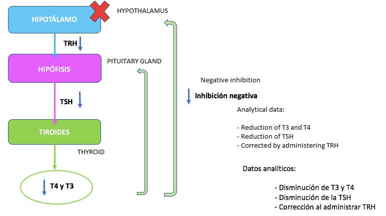 三級性甲狀腺機能低下症