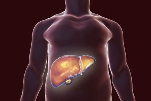 幫助肝臟排毒的最佳自然療法