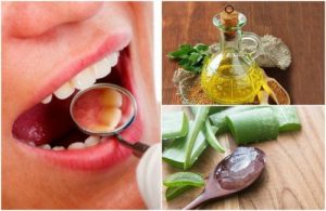 對付牙菌斑的6種簡易居家療法