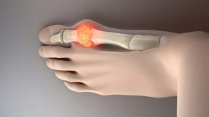 試試這八種降低尿酸的理想食物