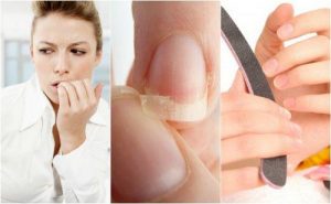 您指甲脆弱的八個原因