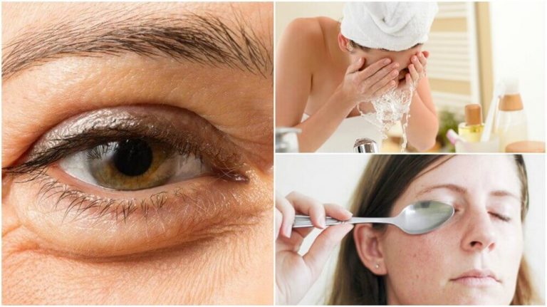 6種減少眼袋的自然方法