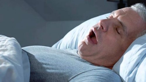 睡眠呼吸中止症