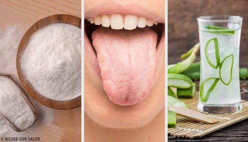 8種解決舌苔發白的自然療法