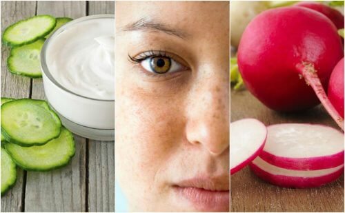 如何用這五種自然療法減少臉上的斑