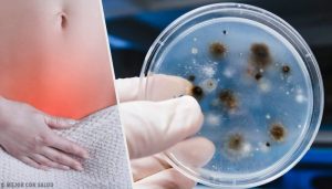 了解陰道感染的類型和成因