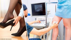 用這3種自然療法,忘了靜脈曲張吧