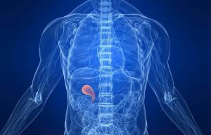 膽囊切除術後的最佳飲食