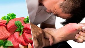 增加尿酸的7種食物