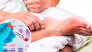 尿酸高的5種常見成因