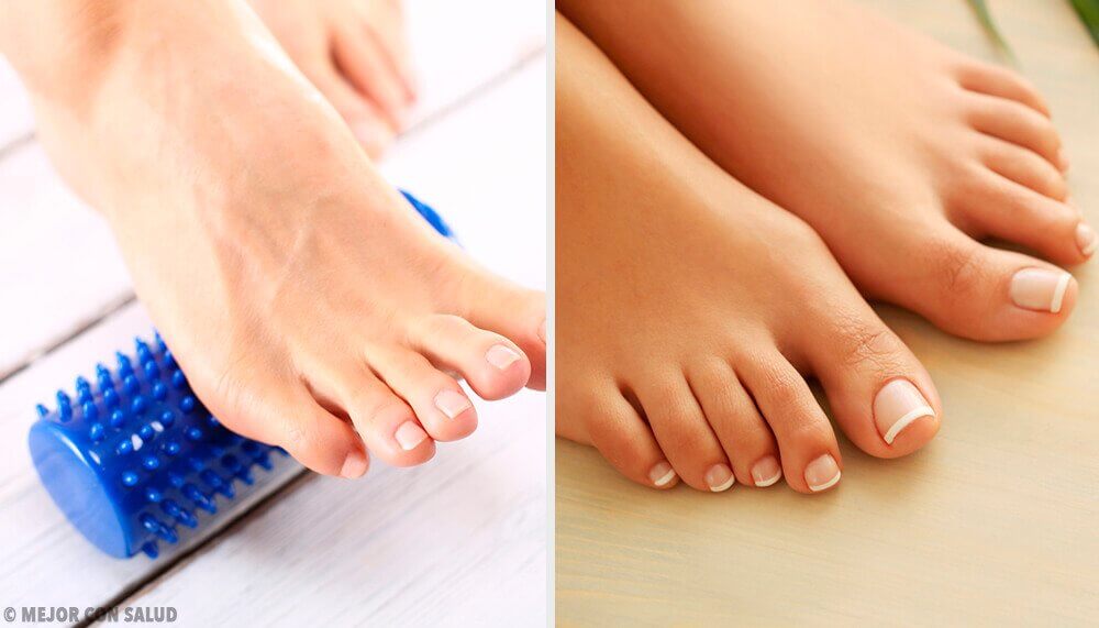 有可能不用手術就消除拇趾外翻嗎