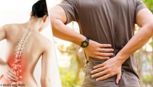 6種導致背痛的健康問題